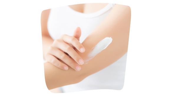 Donna che applica una crema idratante sulla pelle con dermatite atopica come parte del trattamento. Donna che applica una crema idratante sulla pelle con dermatite atopica come parte del trattamento.